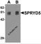 Tripartite Motif-Containing 51 antibody, 6409, ProSci, Western Blot image 