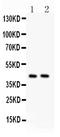 Transmembrane Protein 173 antibody, PB9513, Boster Biological Technology, Western Blot image 