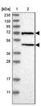 Spermatogenesis Associated 32 antibody, NBP1-93913, Novus Biologicals, Western Blot image 