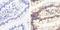 RB Transcriptional Corepressor 1 antibody, GTX24779, GeneTex, Immunohistochemistry paraffin image 