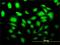 SLC2A4 Regulator antibody, H00056731-M02, Novus Biologicals, Immunofluorescence image 