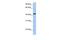 IGF Like Family Receptor 1 antibody, GTX45979, GeneTex, Western Blot image 