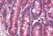 Nuclear Receptor Subfamily 1 Group H Member 3 antibody, MBS247646, MyBioSource, Immunohistochemistry paraffin image 