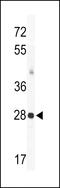 Potassium Voltage-Gated Channel Interacting Protein 3 antibody, MBS9206863, MyBioSource, Western Blot image 