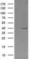 Mitogen-Activated Protein Kinase Kinase 3 antibody, LS-C787886, Lifespan Biosciences, Western Blot image 