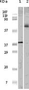 ETS Transcription Factor ELK1 antibody, M01426-1, Boster Biological Technology, Western Blot image 