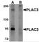 Pappalysin 2 antibody, MBS150746, MyBioSource, Western Blot image 