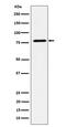 Sec6 antibody, M08984-2, Boster Biological Technology, Western Blot image 