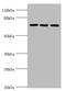 Zinc Finger Protein 699 antibody, A61998-100, Epigentek, Western Blot image 