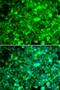 Adiponectin Receptor 1 antibody, LS-B13858, Lifespan Biosciences, Immunofluorescence image 