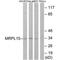 Mitochondrial Ribosomal Protein L19 antibody, PA5-49939, Invitrogen Antibodies, Western Blot image 