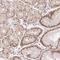 DEK Proto-Oncogene antibody, NBP2-38834, Novus Biologicals, Immunohistochemistry paraffin image 