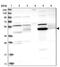 Alcohol Dehydrogenase Iron Containing 1 antibody, PA5-54682, Invitrogen Antibodies, Western Blot image 