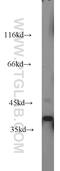 VPS26, Retromer Complex Component B antibody, 15915-1-AP, Proteintech Group, Western Blot image 