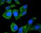 Asparagine Synthetase (Glutamine-Hydrolyzing) antibody, NBP2-67593, Novus Biologicals, Immunofluorescence image 