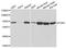 Phosphoglucomutase 1 antibody, A13679, ABclonal Technology, Western Blot image 