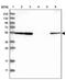Interleukin 17 Receptor C antibody, PA5-54108, Invitrogen Antibodies, Western Blot image 