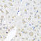 Eukaryotic Translation Initiation Factor 3 Subunit M antibody, A07041, Boster Biological Technology, Immunohistochemistry paraffin image 