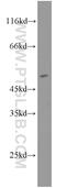 Cytochrome P450 Family 19 Subfamily A Member 1 antibody, 16554-1-AP, Proteintech Group, Western Blot image 