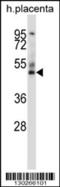 GRAM Domain Containing 2B antibody, 57-544, ProSci, Western Blot image 