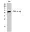 Protein Kinase CAMP-Dependent Type II Regulatory Subunit Alpha antibody, A03911-1, Boster Biological Technology, Western Blot image 