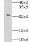 Gsta antibody, FNab03689, FineTest, Western Blot image 