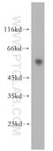 ST3 Beta-Galactoside Alpha-2,3-Sialyltransferase 2 antibody, 13620-1-AP, Proteintech Group, Western Blot image 