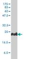 Peroxiredoxin 1 antibody, H00005052-M01, Novus Biologicals, Western Blot image 