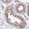 TANK Binding Kinase 1 antibody, NBP2-13416, Novus Biologicals, Immunohistochemistry paraffin image 