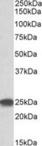 Proteasome Subunit Beta 4 antibody, LS-B8342, Lifespan Biosciences, Western Blot image 