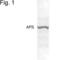 SH2 and PH domain-containing adapter protein APS antibody, PA1-1062, Invitrogen Antibodies, Western Blot image 