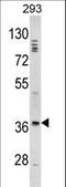 Distal-Less Homeobox 2 antibody, LS-C167445, Lifespan Biosciences, Western Blot image 