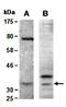 Calponin 1 antibody, orb66946, Biorbyt, Western Blot image 