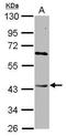 Death Associated Protein Kinase 2 antibody, PA5-34824, Invitrogen Antibodies, Western Blot image 