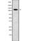 DNA Replication Helicase/Nuclease 2 antibody, PA5-68167, Invitrogen Antibodies, Western Blot image 