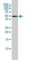 Proteasome 26S Subunit, ATPase 4 antibody, H00005704-M01, Novus Biologicals, Western Blot image 