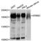 ERBB2 antibody, A2071, ABclonal Technology, Western Blot image 