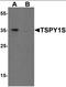 Testis Specific Protein Y-Linked 1 antibody, orb137382, Biorbyt, Western Blot image 