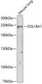 Collagen Type XVIII Alpha 1 Chain antibody, 16-886, ProSci, Western Blot image 