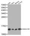 Histone Cluster 1 H2B Family Member A antibody, MBS126488, MyBioSource, Western Blot image 