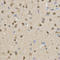 TLE Family Member 1, Transcriptional Corepressor antibody, LS-C334097, Lifespan Biosciences, Immunohistochemistry frozen image 