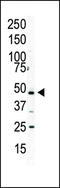 Phosphatidylinositol-5-Phosphate 4-Kinase Type 2 Alpha antibody, 63-361, ProSci, Western Blot image 