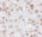 FTO Alpha-Ketoglutarate Dependent Dioxygenase antibody, LS-C108502, Lifespan Biosciences, Immunohistochemistry paraffin image 