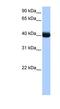 Casein Kinase 1 Gamma 3 antibody, NBP1-57573, Novus Biologicals, Western Blot image 