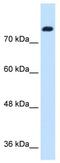 Salt Inducible Kinase 1 antibody, ab64428, Abcam, Western Blot image 