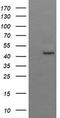 Gamma-Butyrobetaine Hydroxylase 1 antibody, CF505787, Origene, Western Blot image 