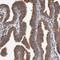 Dishevelled Segment Polarity Protein 2 antibody, NBP1-87550, Novus Biologicals, Immunohistochemistry paraffin image 