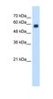 C-Type Lectin Domain Family 4 Member M antibody, orb325005, Biorbyt, Western Blot image 