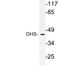 Deoxyhypusine Synthase antibody, LS-C177822, Lifespan Biosciences, Western Blot image 