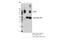 Dipeptidyl Peptidase 4 antibody, 67138S, Cell Signaling Technology, Immunoprecipitation image 